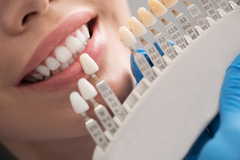 A dentist using a shade guide to color-match a dental crown